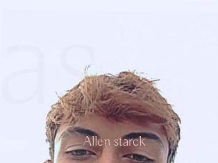 Allen_starck