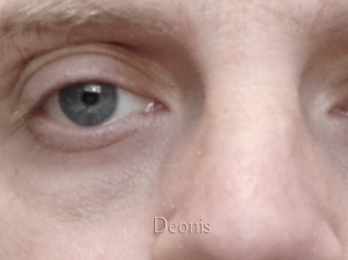 Deonis