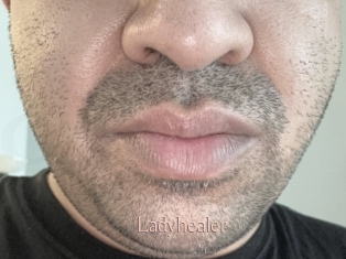Ladyhealer