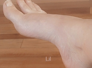 Lil