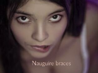 Nauguire_braces